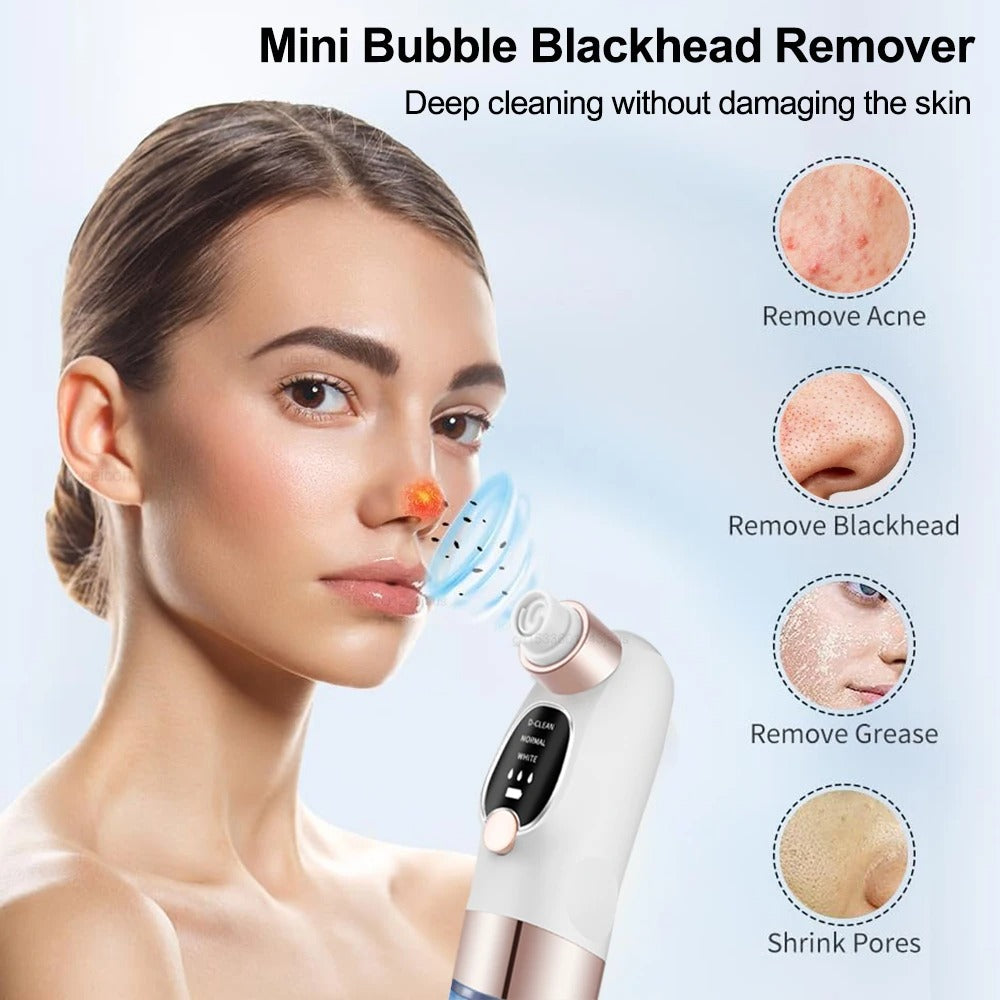 Electric Pore Vacuum Cleaner