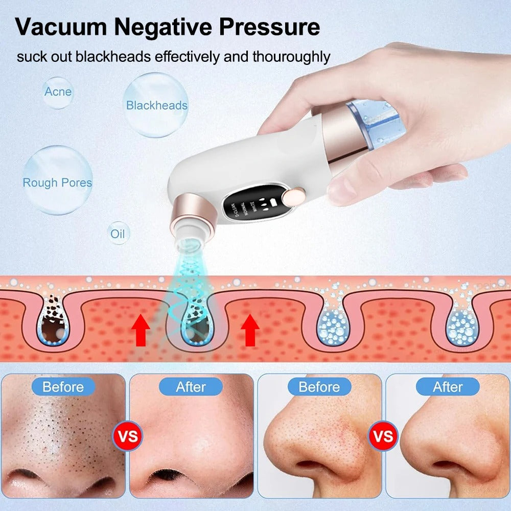 Electric Pore Vacuum Cleaner