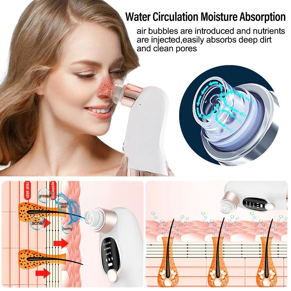 Electric Pore Vacuum Cleaner