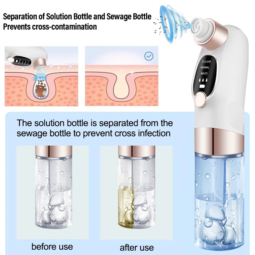 Electric Pore Vacuum Cleaner
