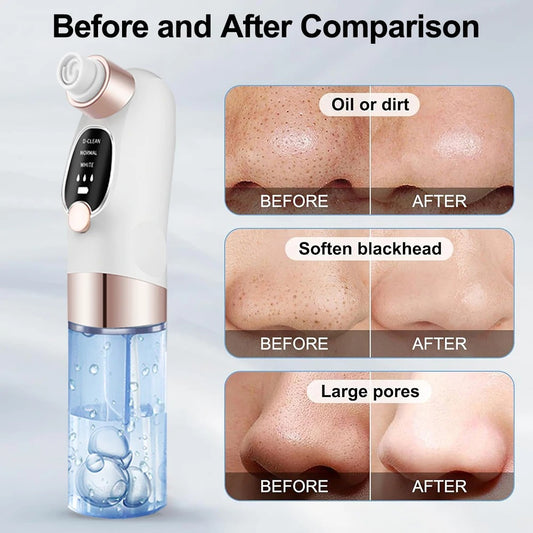Electric Pore Vacuum Cleaner